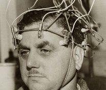 Man-with-electrodes-on-hi-007